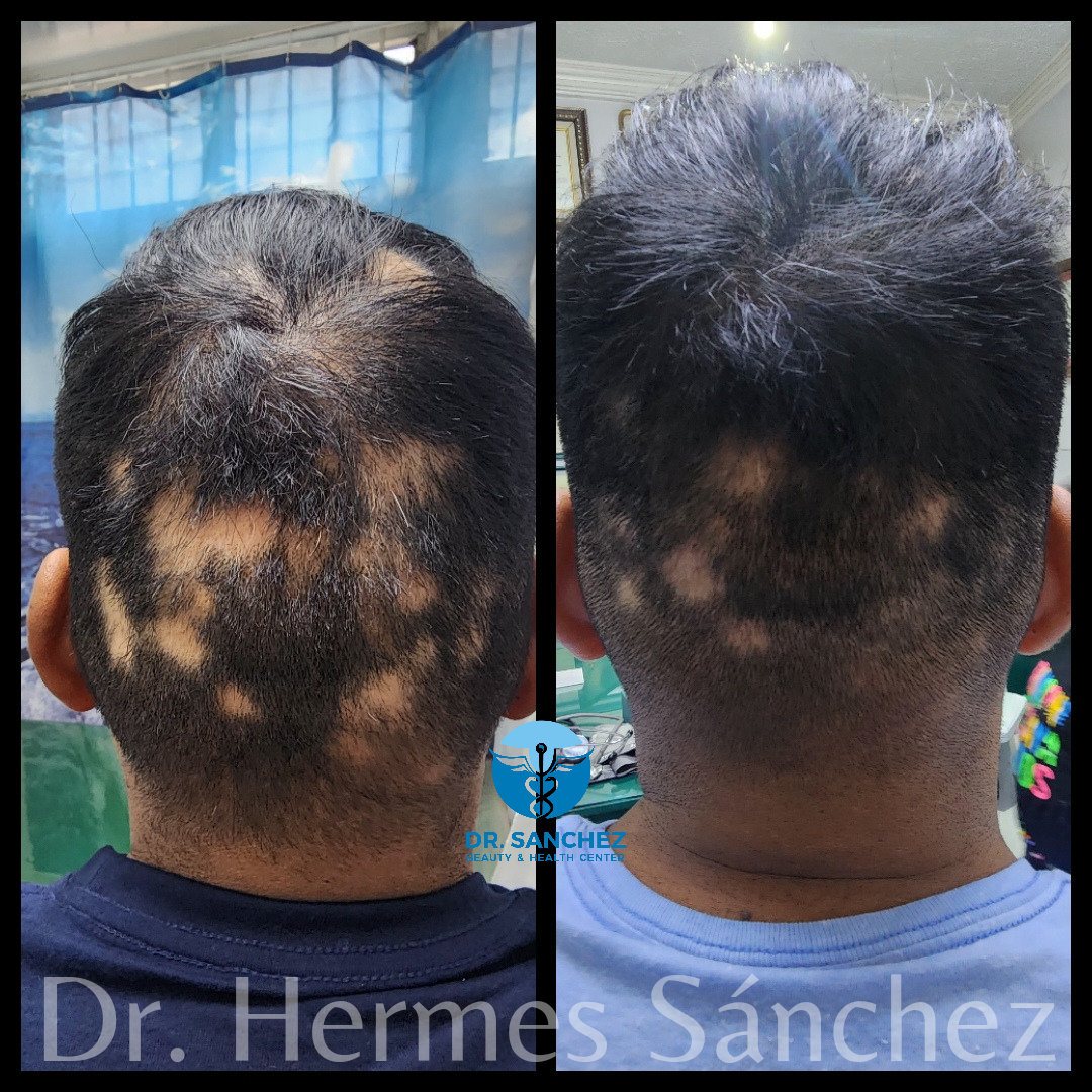 Galería - Transformación 12